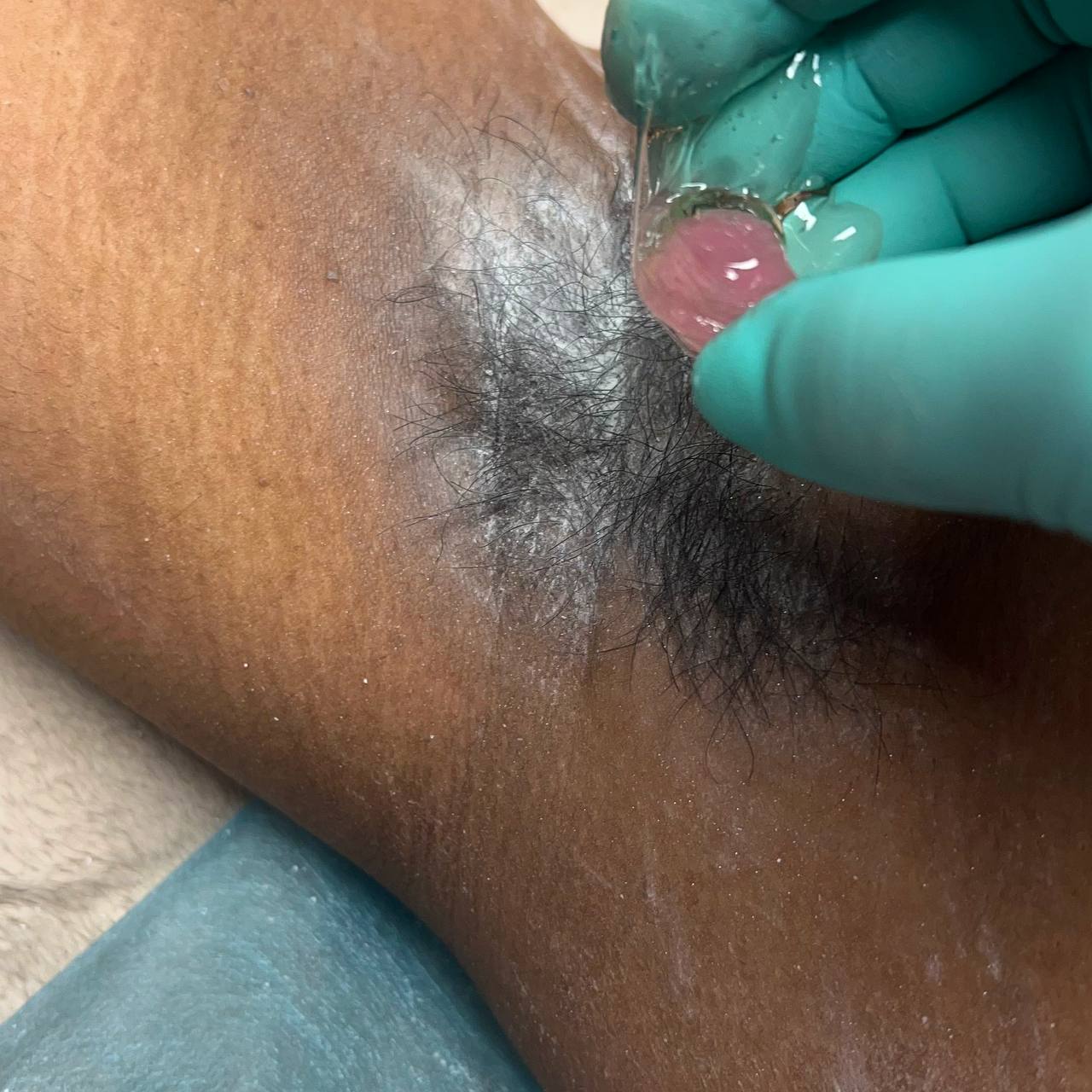 SericaSilk - WHAT SUGARING IS
