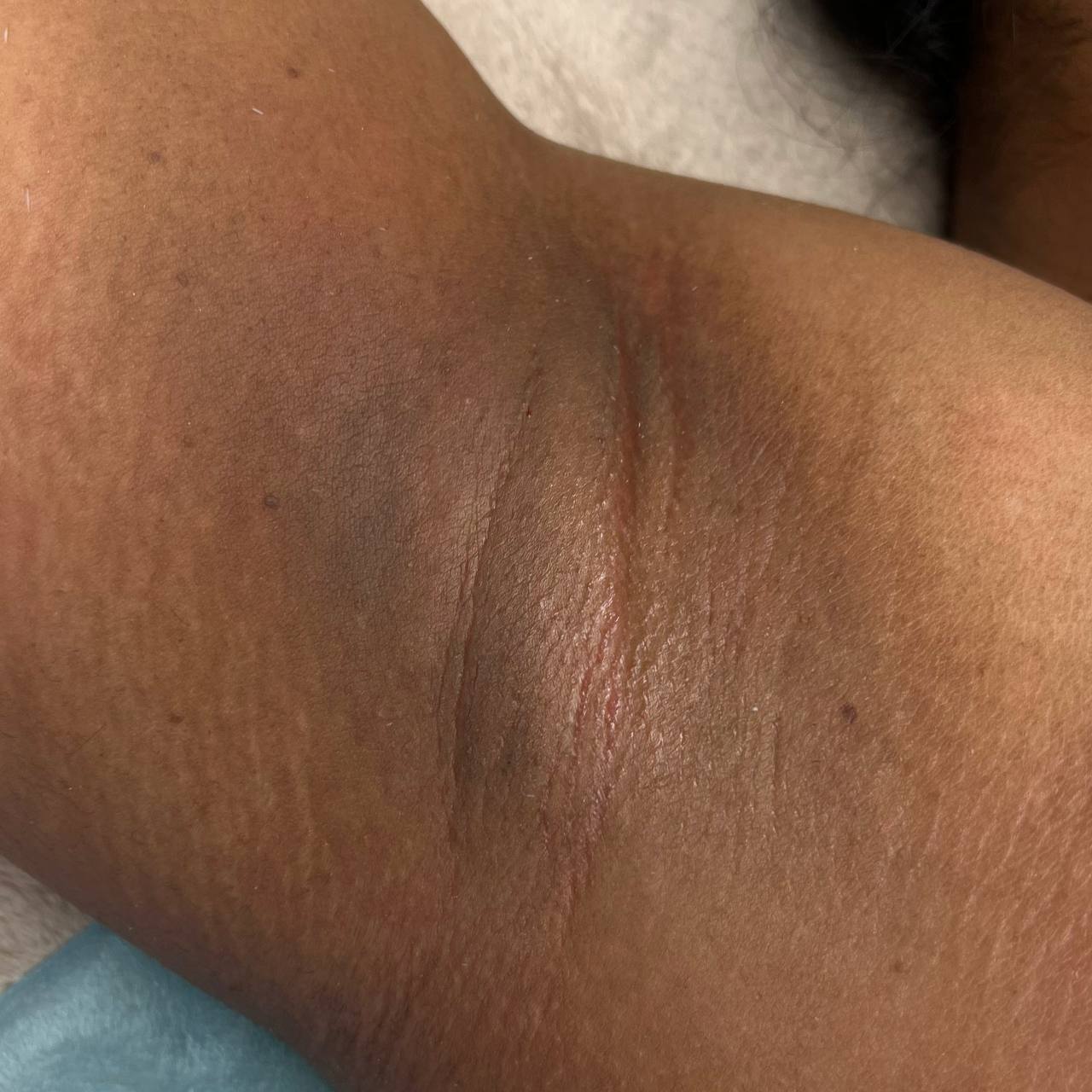 SericaSilk - WHAT SUGARING IS